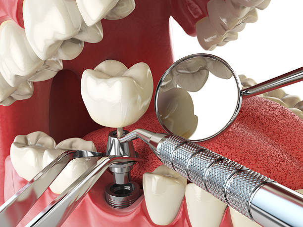 Best Emergency Treatment for Oral Infections in Kremmling, CO