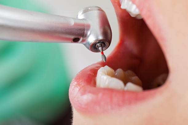 Best Emergency Root Canal Therapy in Kremmling, CO